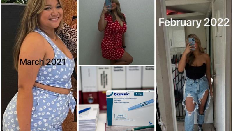 Slăbitul cu Ozempic, medicament pentru diabet, a devenit trend pe TikTok. Val de reţete falsificate, deşi efectele pot fi extrem de grave