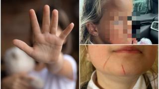 O fetiță de 6 ani s-a întors de la școală bătută și cu părul tăiat, în UK. Mama ei trage un semnal de alarmă: "A venit cu tăieturi pe față"