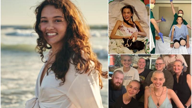 A intrat în moarte clinică de trei ori şi a rămas fără picioare în urma Covid-19. Povestea supermodelului care a iubit prea mult viaţa ca să renunţe la ea
