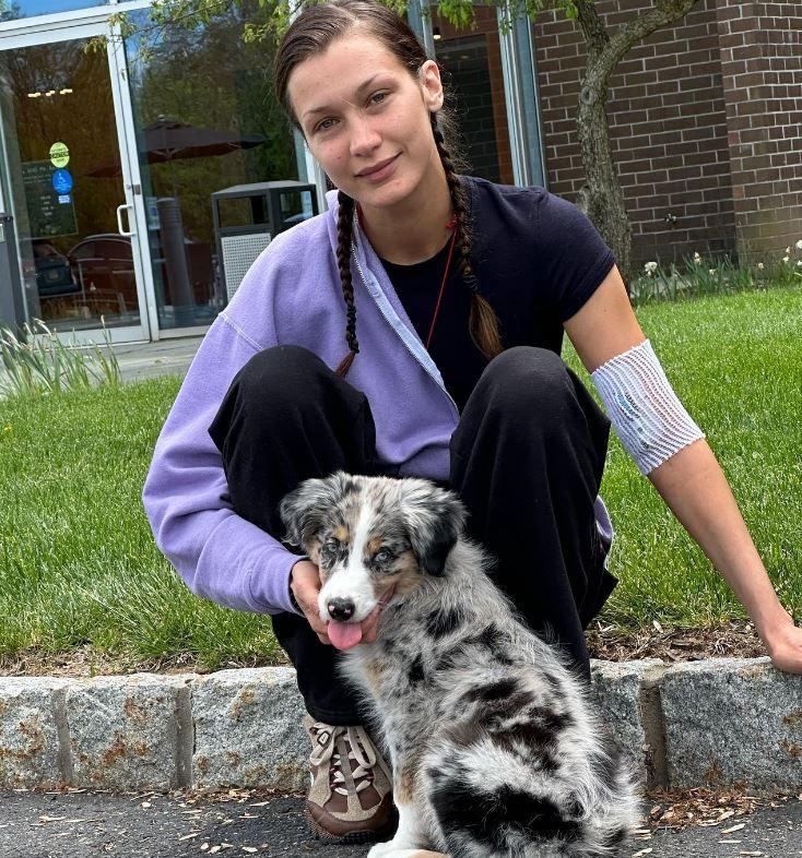 Bella Hadid luptă de 15 ani cu boala Lyme