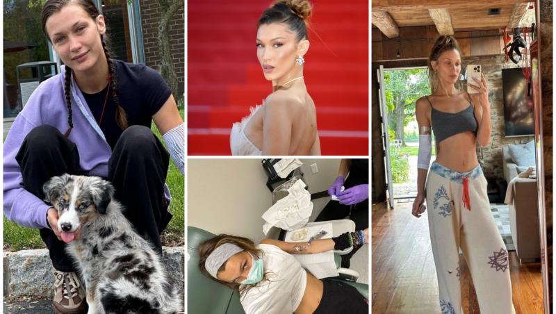 Bella Hadid, mărturii sfâşietoare după "15 ani de suferinţă invizibilă". Supermodelul luptă cu o boală cronică
