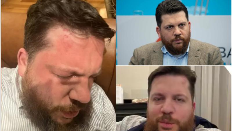 Leonid Volkov, un vechi aliat al lui Alexei Navalnîii, a fost atacat în faţa casei din Lituania cu un ciocan şi gaze lacrimogene: "Un atac politic clar"