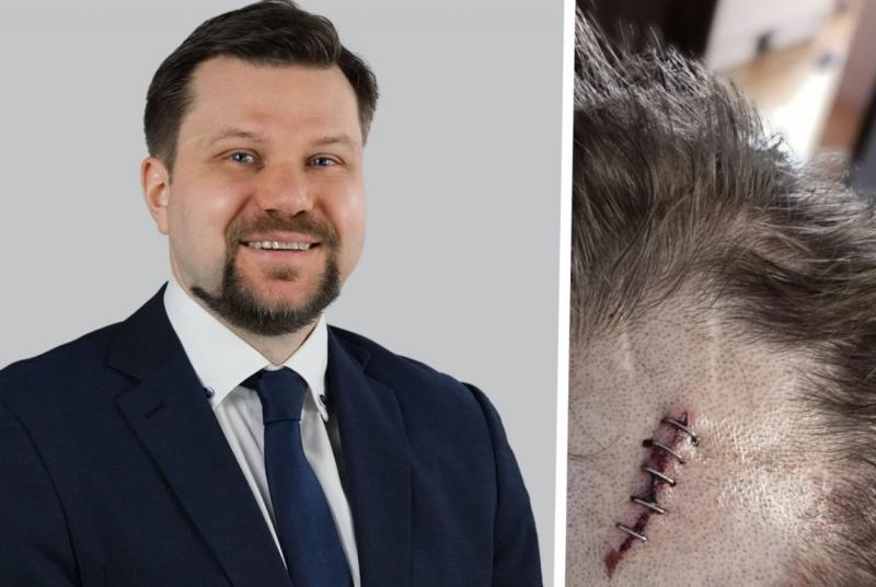 Politician german de extremă-dreapta, lovit cu o scrumieră în cap de un bărbat de stânga. Atacul, motivat politic