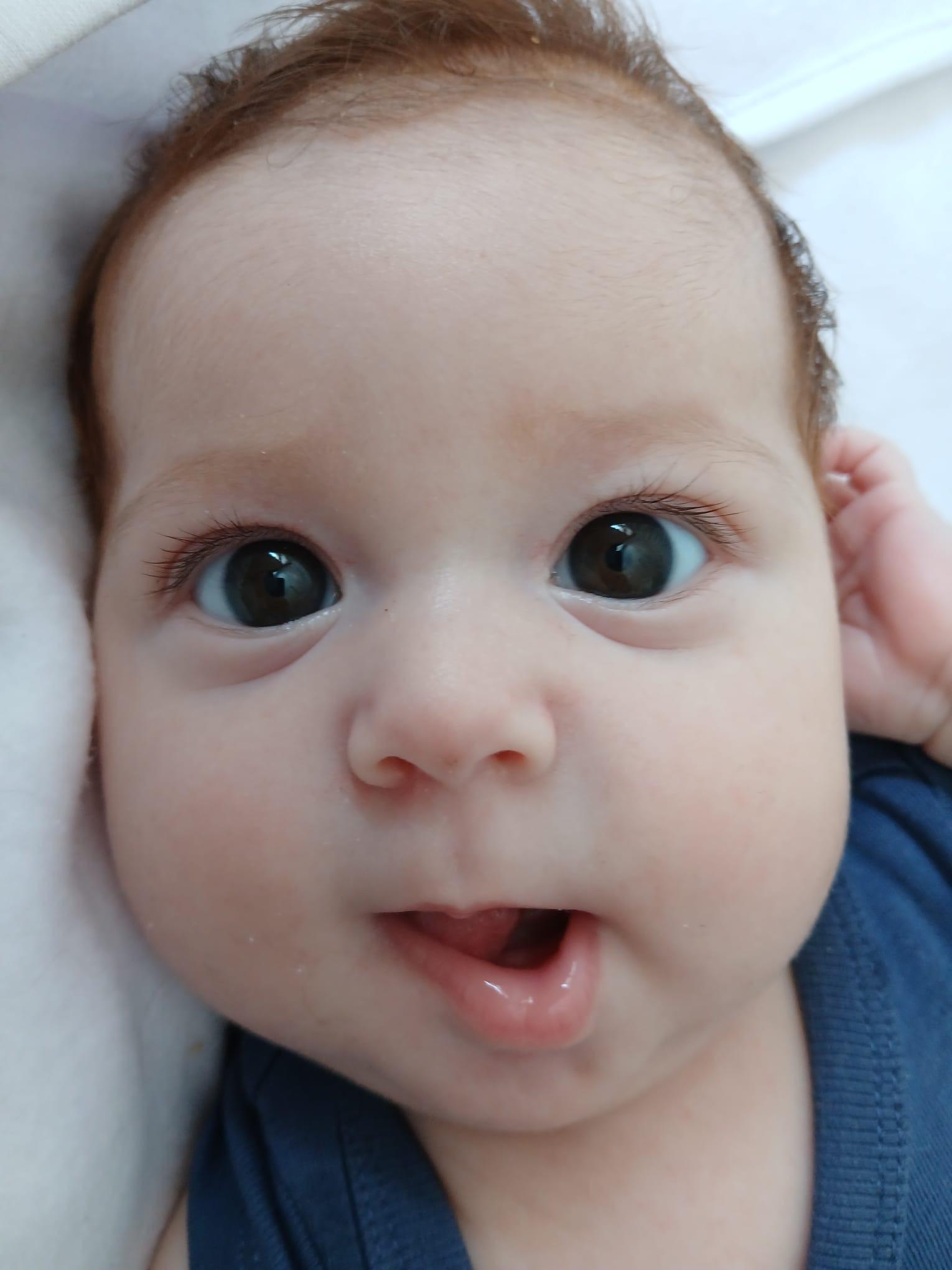 O operație în Serbia este singura șansă pentru Maria, bebelușul de 6 luni născut cu o malformație rară