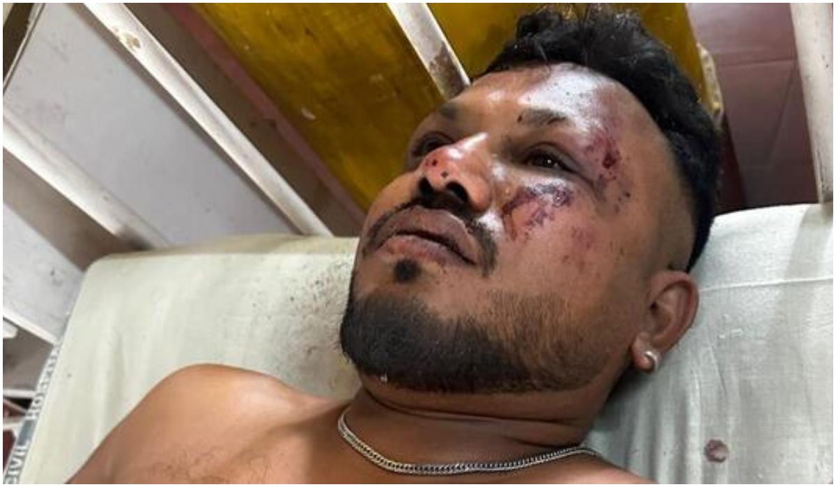 Vishwash Kumar Ramesh, presupus supravieţuitor în urma accidentului aviatic din India