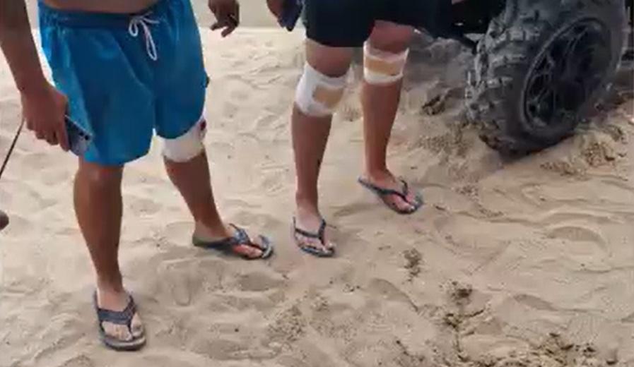 Ultimul weekend de vară s-a lăsăt cu aminitiri dureroase. Mulţi turişti au ieşit din mare şchiopătând