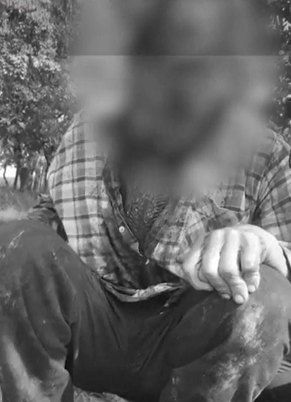 "Era desfoliată toată faţa". A dat nas în nas cu ursul lânga casă. Lupta cu el l-a băgat în spital