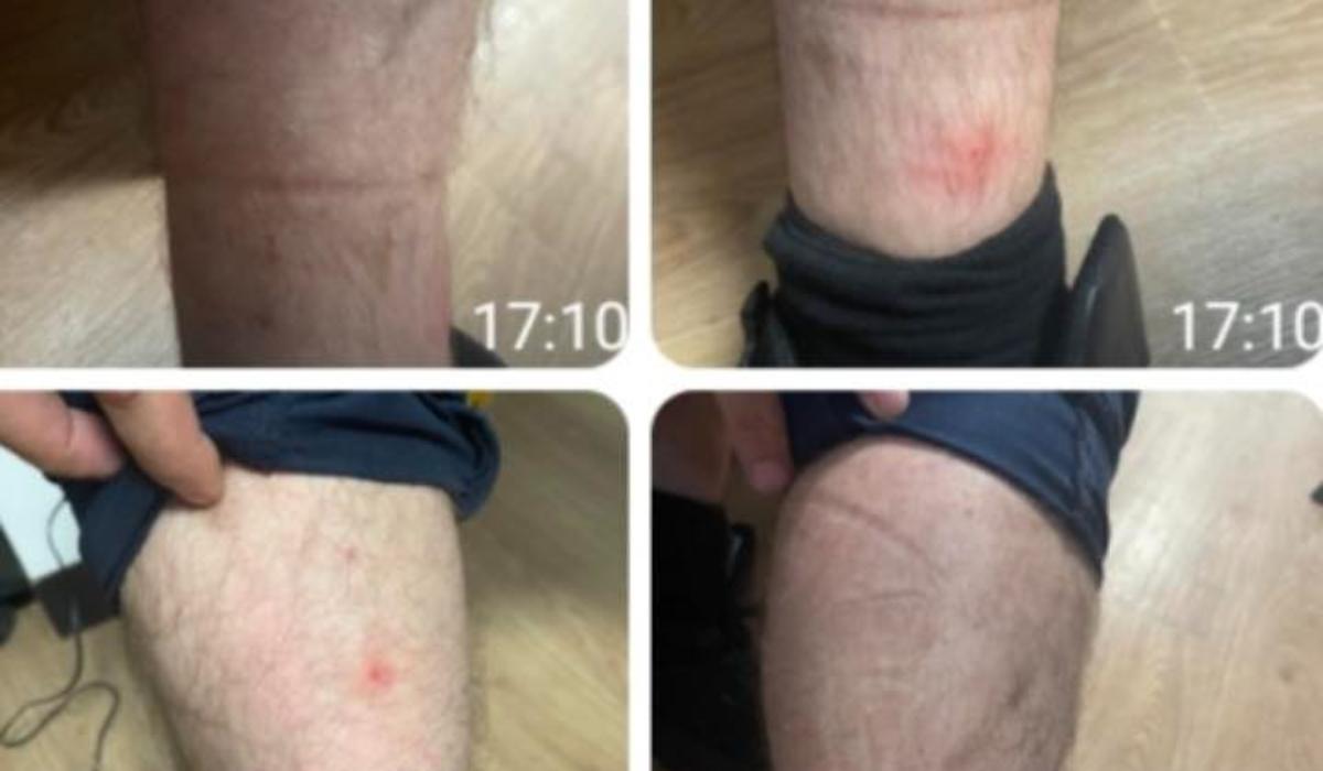 Invazie de ploşniţe la Poliţia Capitalei. Mai mulţi agenţi ar fi ajuns la urgenţe din cauza muşcăturilor