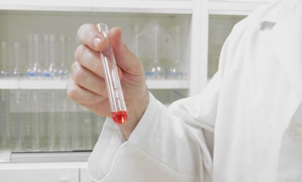 O femeie a murit de ciumă în Rusia, după ce o eprubetă s-ar fi spart la Institutul de Combatere a Ciumei
