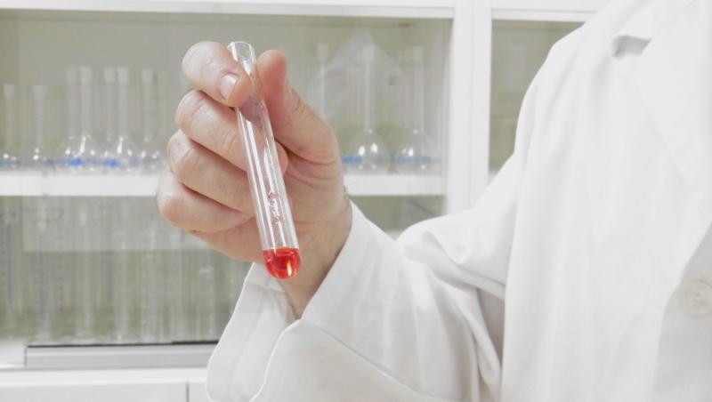 O femeie a murit de ciumă în Rusia, după ce o eprubetă s-ar fi spart la Institutul de Combatere a Ciumei