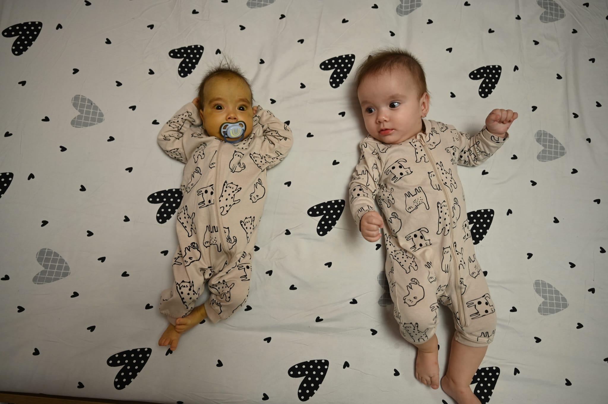 Povestea a două surori gemene de 11 luni: una e cu familia, alta în stare gravă. Cum o poţi ajuta pe Iuliana