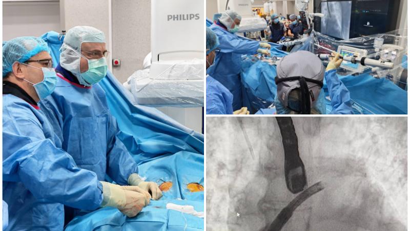 Operaţie rară realizată în România de medicii de la Spitalul de Urgenţă Floreasca. Ce este implantul PASCAL