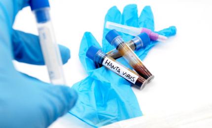 A fost confirmat primul caz de hantavirus în România, la un pacient din Arad. Reacţia INSP