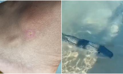 Primul român atacat de peştele-iepure. Turiştii au filmat cum vânează turişti, la mal
