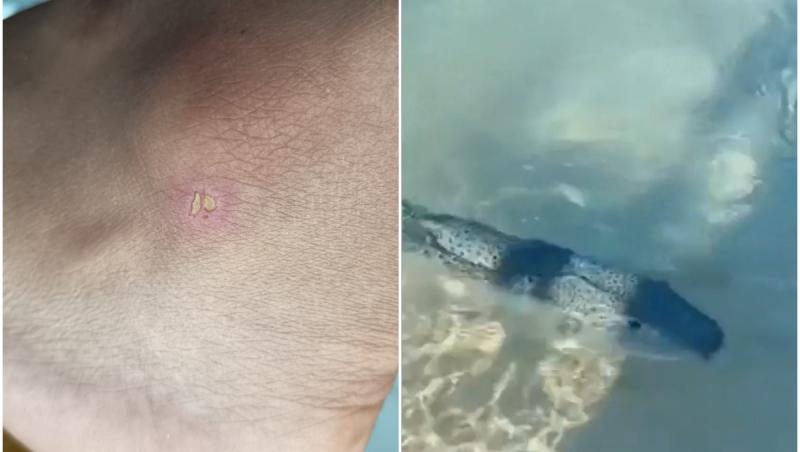 Primul român atacat de peştele-iepure. Turiştii au filmat cum vânează turişti, la mal
