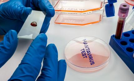 Trei persoane au murit infectate cu hantavirus, în Venezuela. Alte două sunt suspectate