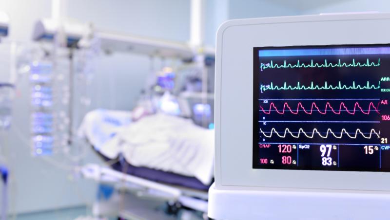 Un român se află în stare critică după ce şi-a dat foc în maşină, în faţa fostei sale iubite în Italia