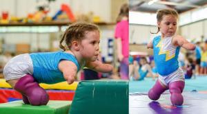O fetiţă de 5 ani, rămasă fără membre din cauza meningitei, face gimnastică: “Nimic nu e imposibil!”