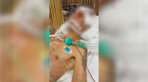 "Au spus că e cardiac şi că a căzut". Un deţinut român din Italia a ajuns în comă la spital, cu răni grave la cap: familia crede că poliţiştii l-au bătut