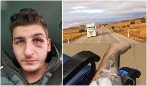 Şofer român de TIR bătut de patronii pentru care lucra, în Spania. L-au ameninţat cu moartea, dacă face plângere