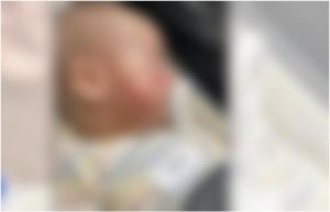 "Cum se poate întâmpla asta accidental?" Mamă din Australia, revoltată după ce și-a luat bebelușul plin de răni pe față dintr-un centru de îngrijire