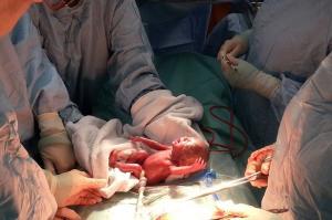 ESTE O FIINŢĂ UMANĂ! Fotografia unei nou-născute la limita AVORTULUI
