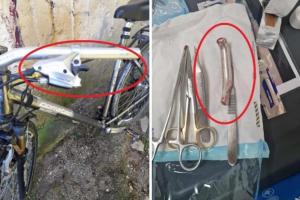Mâner de frână de la bicicletă, cusut în piciorul unui pacient la Spitalul Urlaţi. Bărbatul a ajuns pe mâinile medicilor din Olanda: "M-a tăiat, a scos un fier de 8 cm"