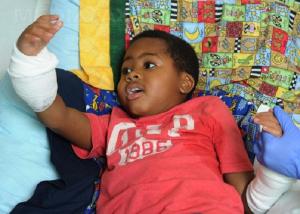 Povestea IMPRESIONANTĂ a lui Zion, băiețelul rămas fără mâini și picioare la vârsta de 2 ani. E incredibil ce poate face acum, la doi ani de la o operație unică în lume (VIDEO)