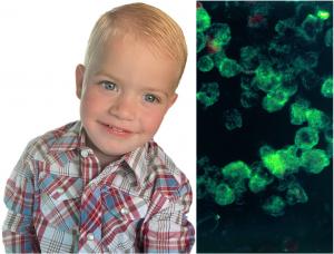 Un băieţel de 2 ani a murit după ce s-a infectat cu o amibă care mănâncă creierul, într-un izvor termal din SUA