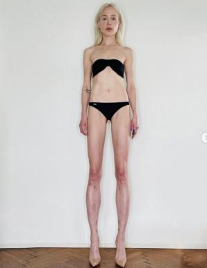 Femeia care și-a lungit picioarele cu 14 centimetri regretă enorm procedura. Cum arată acum influenceriţa din Germania