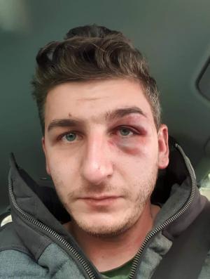 Şofer român de TIR bătut de patronii pentru care lucra, în Spania. L-au ameninţat cu moartea, dacă face plângere
