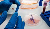 Trei persoane au murit infectate cu hantavirus, în Venezuela. Alte două sunt suspectate