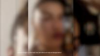 Mărturia tinerei abuzate după ce a leşinat în timpul unui live. "Aş dori să îl întreb o singură chestie"