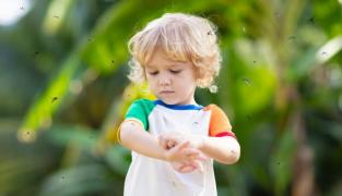 Mușcăturile de insecte la copii. Cum să le tratezi acasă și când să suni medicul