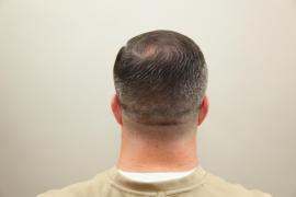 Auzea SUNETE și MIȘCĂRI în ceafă! Medicii s-au ȘOCAT când au văzut ce are ÎN CAP!