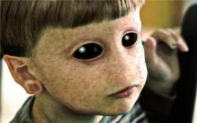 Șocant! Descoperire fără precedent! Copilul fără INIMĂ ȘI PLĂMÂNI