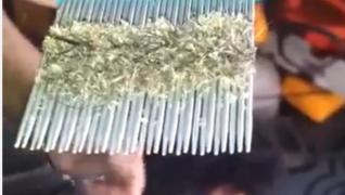 Nu ai mai văzut aşa ceva! Caz EXTREM de infestare cu PĂDUCHI