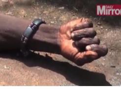 A „înviat” din morți! Un bărbat infectat cu Ebola și-a revenit chiar în fața camerelor tv