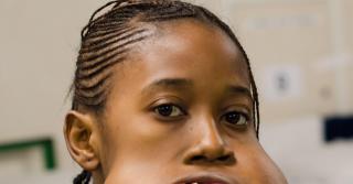 Imagini ÎNGROZITOARE! A avut gura acoperită cu o tumoră CÂT O MINGE DE FOTBAL !