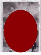 Foto! CUTREMURĂTOR! Cum arată BĂIATUL-BROASCĂ