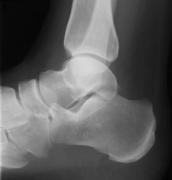 A ajuns la medic din cauza unei dureri! De ani de zile trăia cu el în organism fără să fi ştiut nimic