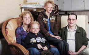 O viață chinuită! Boala care te face să arăți ca un VAMPIR