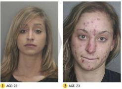 Imagini terifiante! Cum arată aceşti dependenţi de droguri