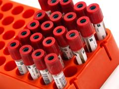 A ucis milioane de oameni în 2012! Iată despre ce este vorba