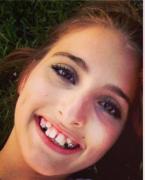 Transformare ULUITOARE! Se temea să zâmbească dar acum toţi o iubesc