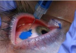 Un trend ÎNFIORĂTOR! Tatuatul ochilor este la mare căutare