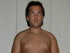 A făcut operaţii de 130.000 de euro ca să devină Ken. Rezultatul nu a fost cel aşteptat