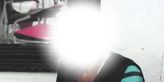 Imagini ŞOCANTE! Cum arată cel care şi-a injectat în faţă ulei de bebeluş