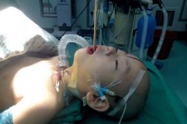 Imagini ȘOCANTE! Bățul de la mâncarea chinezească I-A RĂMAS ÎN CREIER!