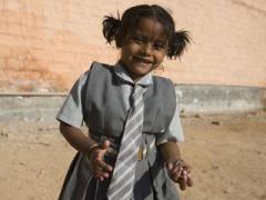 E real sută la sută! Așa arăta FETIȚA CU PATRU MÂINI ȘI PATRU PICIOARE!